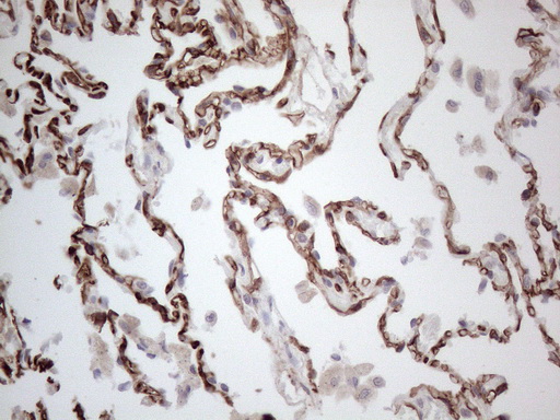 CD34 Antibody - Immunohistochemical staining of paraffin-embedded Human lung tissue within the normal limits using anti-CD34 mouse monoclonal antibody. (Heat-induced epitope retrieval by 1mM EDTA in 10mM Tris buffer. (pH8.5) at 120°C for 3 min. (1:150)