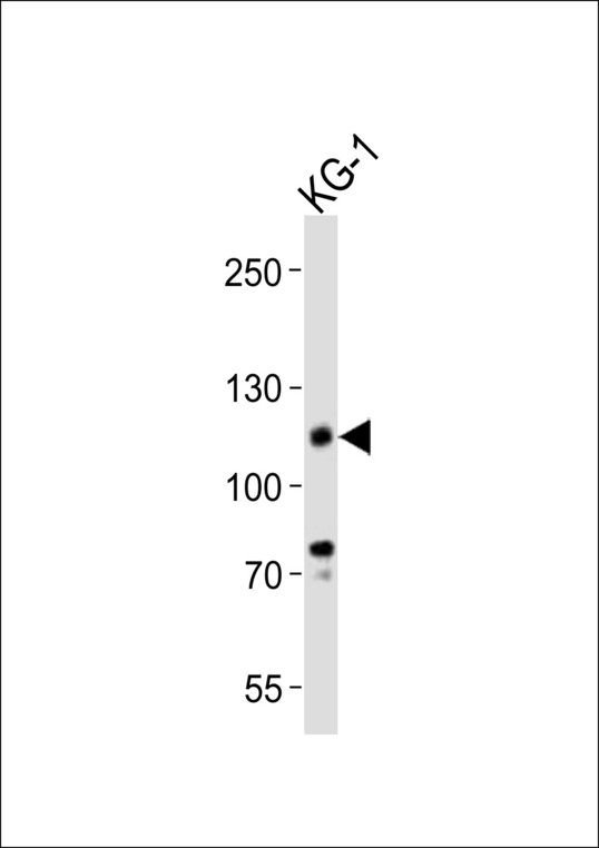 CD34 Antibody - Western blot of lysate from KG-1 cell line, using CD34 antibody diluted at 1:1000. A goat anti-rabbit IgG H&L (HRP) at 1:10000 dilution was used as the secondary antibody. Lysate at 20 ug.
