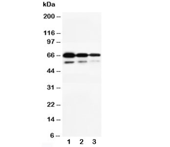 CD34 Antibody - Western blot testing of CD34 antibody and Lane 1: Recombinant human CD34 protein 10ng; 2: 5ng; 3: 2.5ng