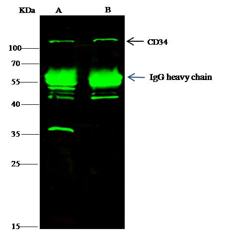 CD34 Antibody - Mouse CD34 was immunoprecipitated using: Lane A: 0.5 mg Hela Whole Cell Lysate. Lane B: 0.5 mg 293T Whole Cell Lysate. 0.5 uL anti-Mouse CD34 rabbit monoclonal antibody and 15 ul of 50% Protein G agarose. Primary antibody: Anti-Mouse CD34 rabbit monoclonal antibody, at 1:350 dilution. Secondary antibody: Dylight 800-labeled antibody to rabbit IgG (H+L), at 1:5000 dilution. Developed using the odssey technique. Performed under reducing conditions. Predicted band size: 41 kDa. Observed band size: 130 kDa.