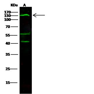 CD34 Antibody - Anti-CD34 rabbit monoclonal antibody at 1:500 dilution. Lane A: TF-1 Whole Cell Lysate. Lysates/proteins at 30 ug per lane. Secondary: Goat Anti-Rabbit IgG H&L (Dylight800) at 1/10000 dilution. Developed using the Odyssey technique. Performed under reducing conditions. Predicted band size: 41 kDa. Observed band size: 130 kDa. (We are unsure as to the identity of these extra bands.)