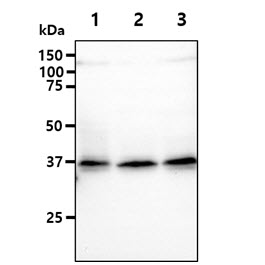 CD34 Antibody - The cell lysates (40ug) were resolved by SDS-PAGE, transferred to PVDF membrane and probed with anti-human CD34 antibody (1:500). Proteins were visualized using a goat anti-mouse secondary antibody conjugated to HRP and an ECL detection system. Lane 1.: TF1 cell lysate Lane 2.: HeLa cell lysate Lane 3.: Jurkat cell lysate