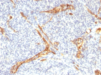 CD34 Antibody - Formalin-fixed, paraffin-embedded human Tonsil stained with CD34 Recombinant Rabbit Monoclonal Antibody (HPCA1/2598R).