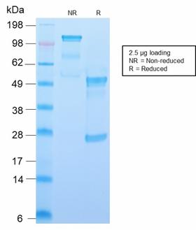 CD34 Antibody - SDS-PAGE Analysis Purified CD34 Recombinant Rabbit Monoclonal Antibody (HPCA1/2598R). Confirmation of Purity and Integrity of Antibody.