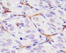 CD34 Antibody - CD34 Antibody (MEC 14.7) - Hematopoietic Stem Cell Marker - IHC of CD34 on mouse renal cancer xenograft.  This image was taken for the unconjugated form of this product. Other forms have not been tested.