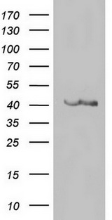 CD34 Antibody - HEK293T cells were transfected with the pCMV6-ENTRY control (Left lane) or pCMV6-ENTRY CD34 (Right lane) cDNA for 48 hrs and lysed. Equivalent amounts of cell lysates (5 ug per lane) were separated by SDS-PAGE and immunoblotted with anti-CD34.