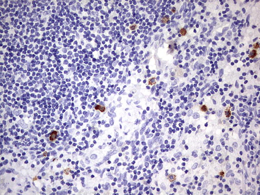 CD34 Antibody - IHC of paraffin-embedded Human lymph node tissue using anti-CD34 mouse monoclonal antibody. (Heat-induced epitope retrieval by 1 mM EDTA in 10mM Tris, pH8.5, 120°C for 3min).