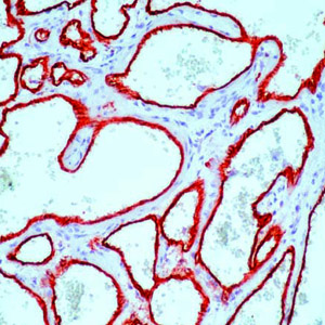 CD34 Antibody - Formalin-fixed, paraffin-embedded human tonsil stained with CD34, Endothelial Cell antibody.