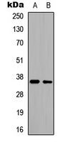 CD34 Antibody - Western blot analysis of CD34 expression in HeLa (A); HepG2 (B) whole cell lysates.