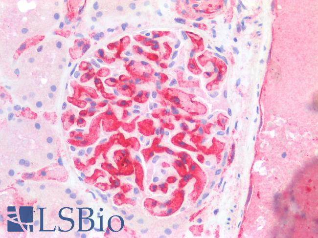 CD34 Antibody - Human Kidney: Formalin-Fixed, Paraffin-Embedded (FFPE)