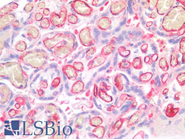 CD34 Antibody - Human Placenta: Formalin-Fixed, Paraffin-Embedded (FFPE)