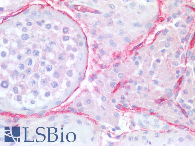 CD34 Antibody - Human Testis: Formalin-Fixed, Paraffin-Embedded (FFPE)