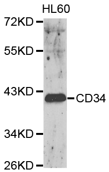 CD34 Antibody - Western blot of CD34 pAb in extracts from HL60 cells.