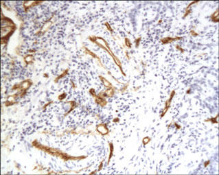 CD34 Antibody - Paraffin-embedded mouse brain is stained with CD34 Antibody used at 1:100 dilution.