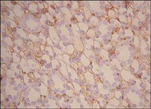 CD34 Antibody - CD34 staining in rat kidney. Paraffin-embedded rat kidney is stained with CD34 antibody used at 1:100 dilution (data from Liu et al., PLOS, 2013).