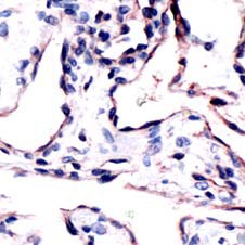 CD34 Antibody - Human lung stained with Anti-CD34 antibody