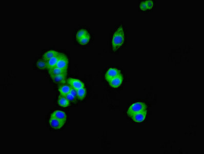 CD34 Antibody - Immunofluorescent analysis of PC3 cells diluted at 1:100 and Alexa Fluor 488-congugated AffiniPure Goat Anti-Rabbit IgG(H+L)