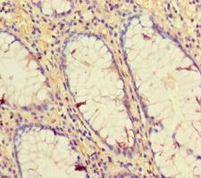 CD34 Antibody - Immunohistochemistry of paraffin-embedded human colon cancer at dilution of 1:100