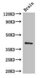 CD34 Antibody - Western Blot Positive WB detected in:Mouse brain tissue All Lanes: CD34 antibody at 3ug/ml Secondary Goat polyclonal to rabbit IgG at 1/50000 dilution Predicted band size: 41,36 kDa Observed band size: 41 kDa