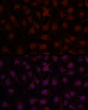 CD34 Antibody - Immunofluorescence analysis of HUVEC cells using CD34 antibody at dilution of 1:100 (40x lens). Blue: DAPI for nuclear staining.