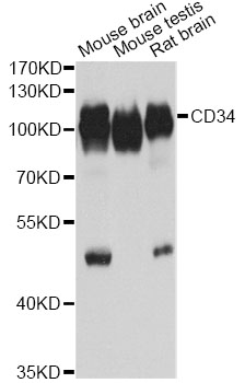 CD34 Antibody - Western blot analysis of extracts of various cell lines, using CD34 Antibody at 1:1000 dilution. The secondary antibody used was an HRP Goat Anti-Rabbit IgG (H+L) at 1:10000 dilution. Lysates were loaded 25ug per lane and 3% nonfat dry milk in TBST was used for blocking. An ECL Kit was used for detection and the exposure time was 45s.