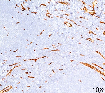 CD34 Antibody - CD34 antibody QBEnd/10 immunohistochemistry 10X.  This image was taken for the unmodified form of this product. Other forms have not been tested.