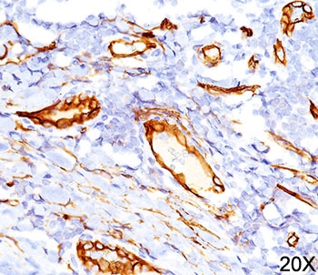 CD34 Antibody - CD34 antibody QBEnd/10 immunohistochemistry 20X.  This image was taken for the unmodified form of this product. Other forms have not been tested.
