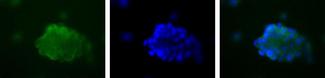 CD36 Antibody - Adipocytes 40x.  This image was taken for the unconjugated form of this product. Other forms have not been tested.