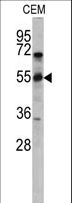 CD36 Antibody - Western blot of CD36 antibody in CEM cell line lysates (35 ug/lane). CD36 (arrow) was detected using the purified antibody.
