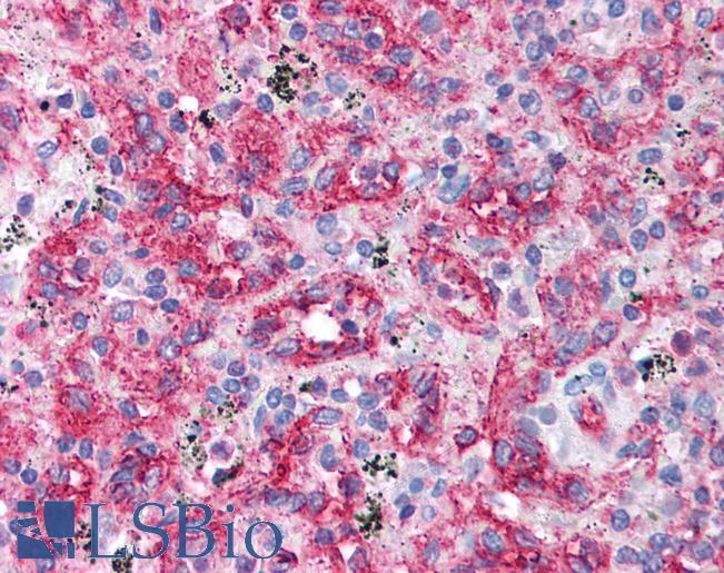 CD36 Antibody - Anti-CD36 antibody IHC of human spleen. Immunohistochemistry of formalin-fixed, paraffin-embedded tissue after heat-induced antigen retrieval. Antibody concentration 5 ug/ml.  This image was taken for the unconjugated form of this product. Other forms have not been tested.