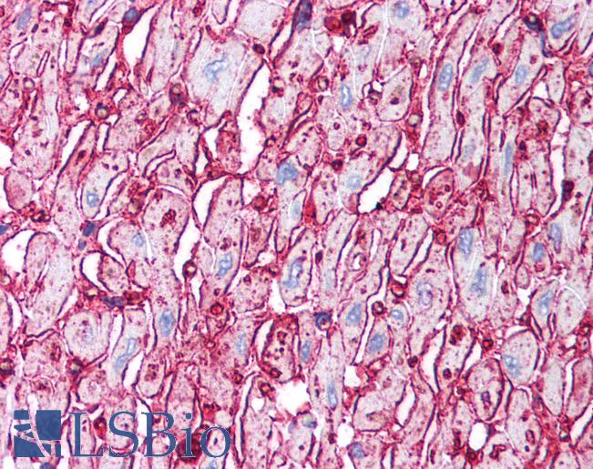 CD36 Antibody - Anti-CD36 antibody IHC of human heart. Immunohistochemistry of formalin-fixed, paraffin-embedded tissue after heat-induced antigen retrieval. Antibody concentration 5 ug/ml.  This image was taken for the unconjugated form of this product. Other forms have not been tested.