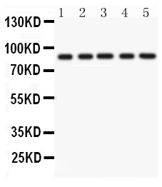 CD36 Antibody - CD36 antibody Western blot. All lanes: Anti CD36 at 0.5 ug/ml. Lane 1: Rat Liver Tissue Lysate at 50 ug. Lane 2: Rat Cardiac Muscle Tissue Lysate at 50 ug. Lane 3: Mouse Liver Tissue Lysate at 50 ug. Lane 4: Mouse Cardiac Muscle Tissue Lysate at 50 ug. Lane 5: SMMC Whole Cell Lysate at 40 ug. Predicted band size: 53 kD. Observed band size: 88 kD.