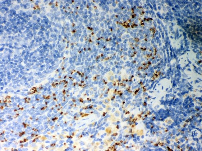 CD36 Antibody - CD36 antibody IHC-paraffin: Rat Spleen Tissue.
