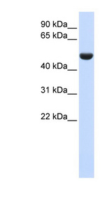 CD36 Antibody - CD36 antibody Western blot of Fetal Liver lysate. This image was taken for the unconjugated form of this product. Other forms have not been tested.