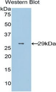 CD36 Antibody - Western blot of recombinant CD36.  This image was taken for the unconjugated form of this product. Other forms have not been tested.