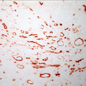 CD36 Antibody - Frozen human tonsil section stained with UltraVision LP and AEC chromogen. Note staining of monocytes, macrophages and endothelial cells.  This image was taken for the unmodified form of this product. Other forms have not been tested.