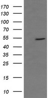CD36 Antibody - HEK293T cells were transfected with the pCMV6-ENTRY control (Left lane) or pCMV6-ENTRY CD36 (Right lane) cDNA for 48 hrs and lysed. Equivalent amounts of cell lysates (5 ug per lane) were separated by SDS-PAGE and immunoblotted with anti-CD36.