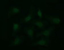CD36 Antibody - Immunofluorescent staining of HeLa cells using anti-CD36 mouse monoclonal antibody.
