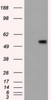 CD36 Antibody - HEK293T cells were transfected with the pCMV6-ENTRY control (Left lane) or pCMV6-ENTRY CD36 (Right lane) cDNA for 48 hrs and lysed. Equivalent amounts of cell lysates (5 ug per lane) were separated by SDS-PAGE and immunoblotted with anti-CD36.