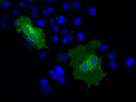CD36 Antibody - Anti-CD36 mouse monoclonal antibody  immunofluorescent staining of COS7 cells transiently transfected by pCMV6-ENTRY CD36.