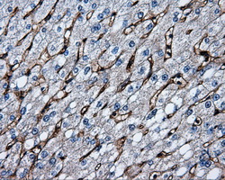 CD36 Antibody - Immunohistochemical staining of paraffin-embedded liver tissue using anti-CD36 mouse monoclonal antibody. (Dilution 1:50).