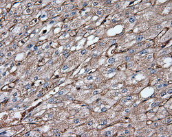 CD36 Antibody - Immunohistochemical staining of paraffin-embedded liver tissue using anti-CD36 mouse monoclonal antibody. (Dilution 1:50).