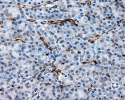 CD36 Antibody - Immunohistochemical staining of paraffin-embedded pancreas tissue using anti-CD36 mouse monoclonal antibody. (Dilution 1:50).