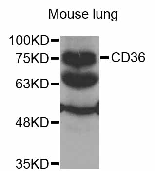 CD36 Antibody - Western blot analysis of extracts of Mouse lung cells.