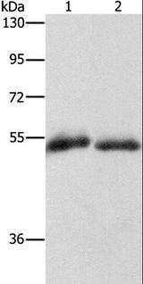 CD36 Antibody - Western blot analysis of Human placenta and fat tissue, using CD36 Polyclonal Antibody at dilution of 1:1000.
