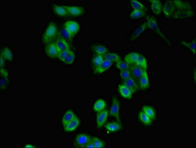 CD36 Antibody - Immunofluorescent analysis of HepG2 cells at a dilution of 1:100 and Alexa Fluor 488-congugated AffiniPure Goat Anti-Rabbit IgG(H+L)