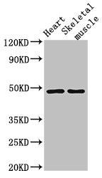 CD36 Antibody - Positive Western Blot detected in Mouse heart tissue, Mouse skeletal muscle tissue. All lanes: CD36 antibody at 2 µg/ml Secondary Goat polyclonal to rabbit IgG at 1/50000 dilution. Predicted band size: 54, 33, 49, 47 KDa. Observed band size: 49 KDa