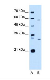 CD36 Antibody - Lane A: Marker. Lane B: HepG2 cell lysate. Antibody concentration: 1.0 ug/ml. Gel concentration: 12%.  This image was taken for the unconjugated form of this product. Other forms have not been tested.