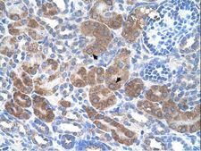 CD36 Antibody - CD36 antibody CD36(CD36 molecule (thrombospondin receptor)) Antibody was used in IHC to stain formalin-fixed, paraffin-embedded human kidney.  This image was taken for the unconjugated form of this product. Other forms have not been tested.