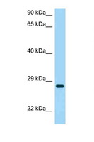 CD37 Antibody - CD37 antibody Western blot of HeLa Cell lysate. Antibody concentration 1 ug/ml.  This image was taken for the unconjugated form of this product. Other forms have not been tested.